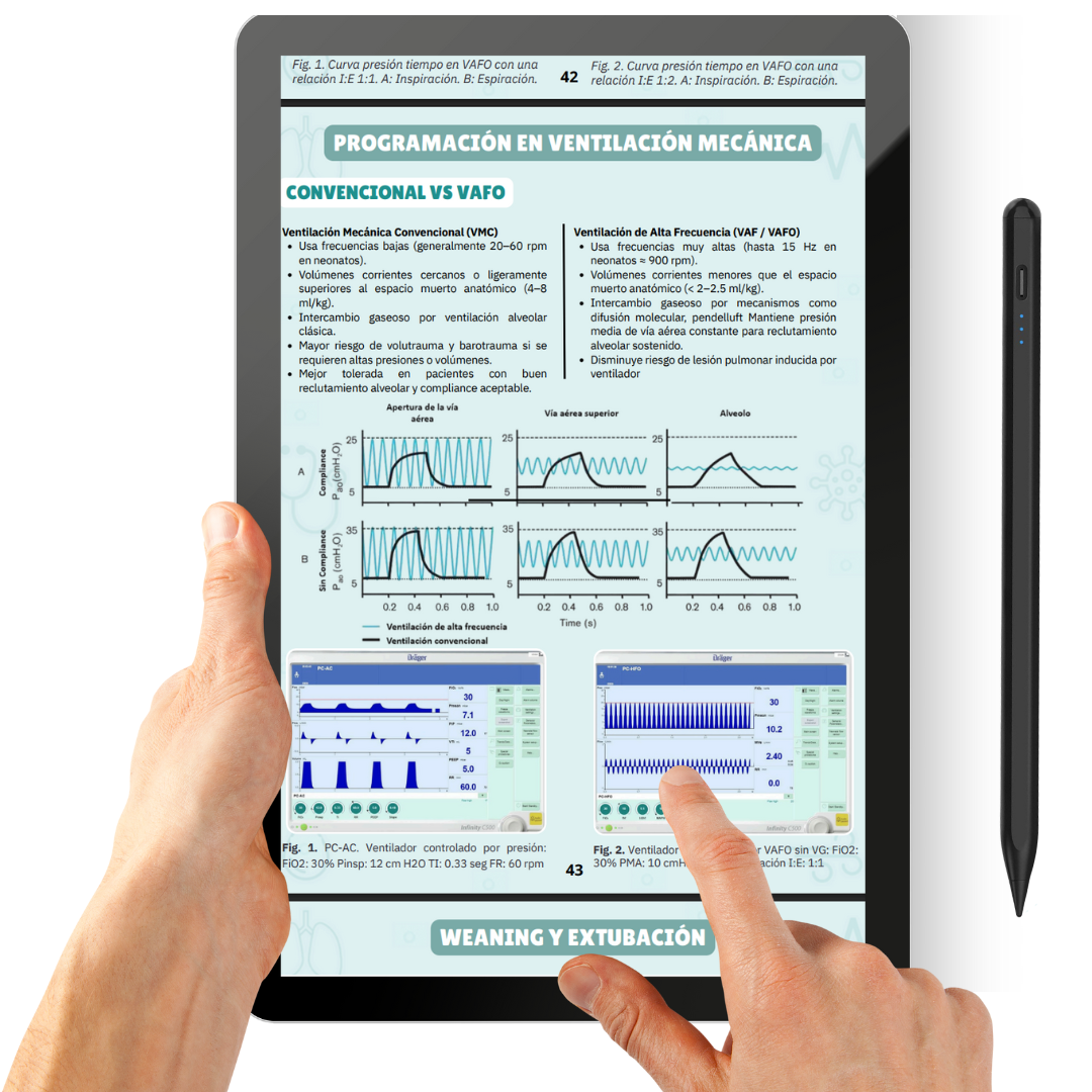 Manual de Ventilación Mecánica en Pediatría y Neonatología + PDF Casos Clínicos y Preguntas