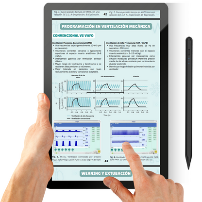 Manual de Ventilación Mecánica en Pediatría y Neonatología + PDF Casos Clínicos y Preguntas
